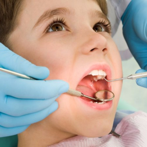 Лечение кариеса молочных зубов у детей